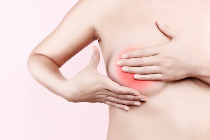 как лечить уплотнение в молочной железе при грудном вскармливании