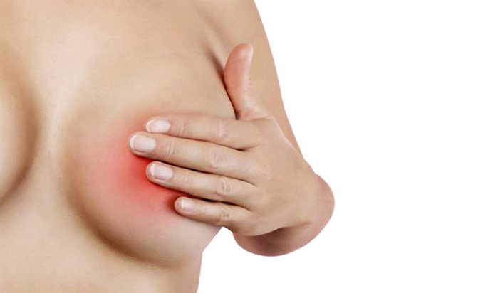 Причины жжения в груди при грудном вскармливании